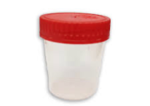 RECOLECTOR DE Orina